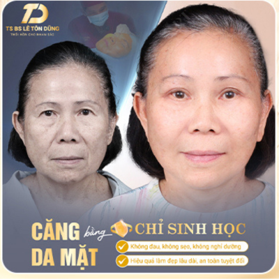 CĂNG DA MẶT