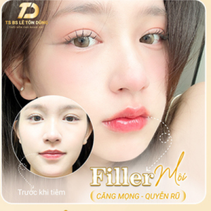 tiem-filler